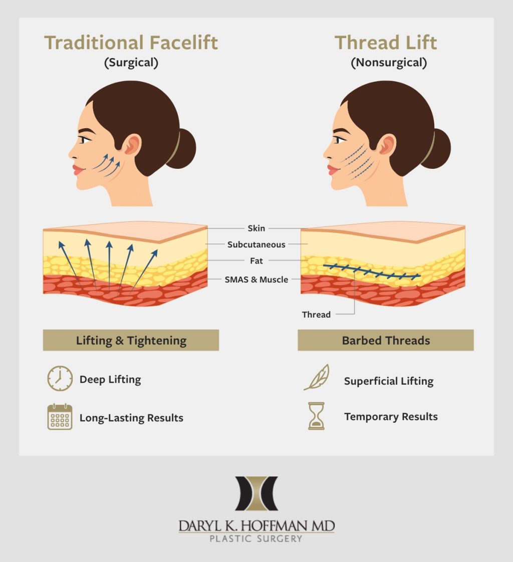 Simple visual guide to comparing traditional facelifts to thread lifts