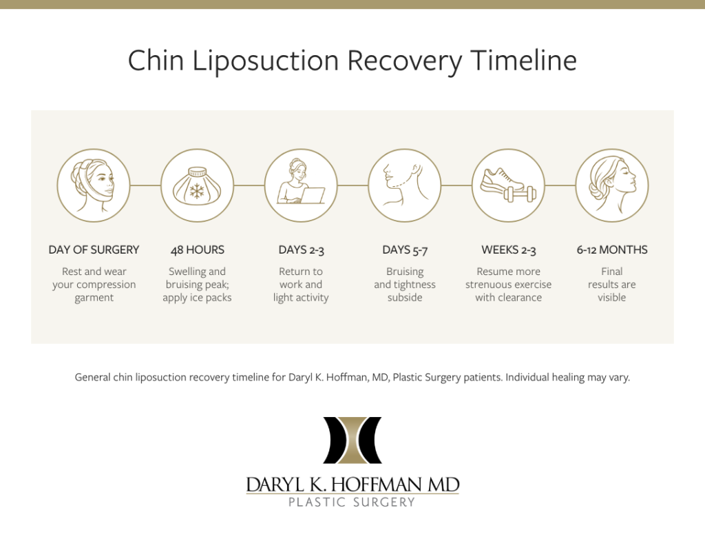 Chin liposuction recovery timeline: rest and wear compression on surgery day; swelling and bruising peak at 48 hours; return to work and light activity by days 2–3; bruising and tightness subside by days 5–7; resume strenuous exercise with clearance at weeks 2–3; final results appear at 6–12 months. Individual healing may vary.